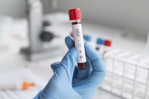 Descubra Aqui Se Os Planos De Saude Sao Obrigados A Cobrir Portadores De Hiv