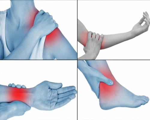 Descubra Um Pouco Mais Sobre Tendinite