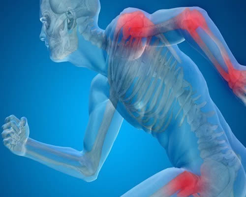 O Que E Osteoporose E Como Ela Age