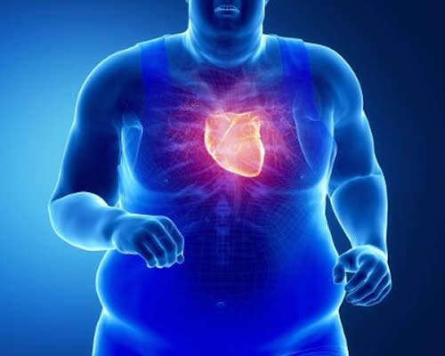 Quais Os Problemas Que Obesidade Pode Nos Causar Longo Prazo