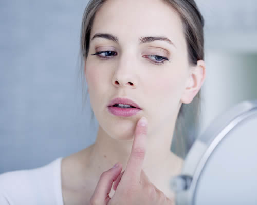 Tudo Sobre Herpes Labial